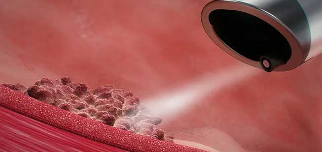 Vessi Medical header image