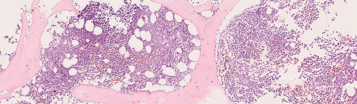 Spotlight Pathology header image
