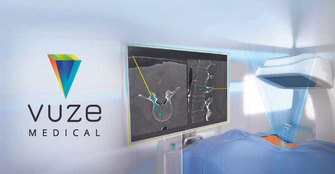 VUZE Medical header image